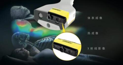 康耐視3D-A5060三維面陣視覺(jué)系統(tǒng)助力精準(zhǔn)放療，實(shí)現(xiàn)人體定位監(jiān)控新維度(圖1)