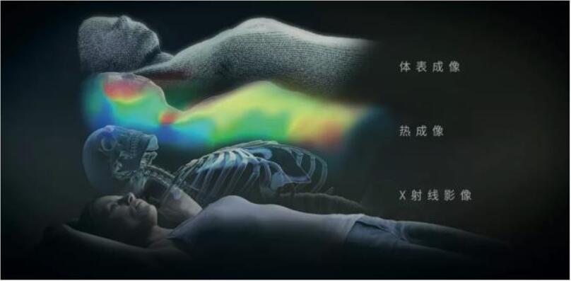 康耐視3D-A5060三維面陣視覺(jué)系統(tǒng)助力精準(zhǔn)放療，實(shí)現(xiàn)人體定位監(jiān)控新維度(圖3)